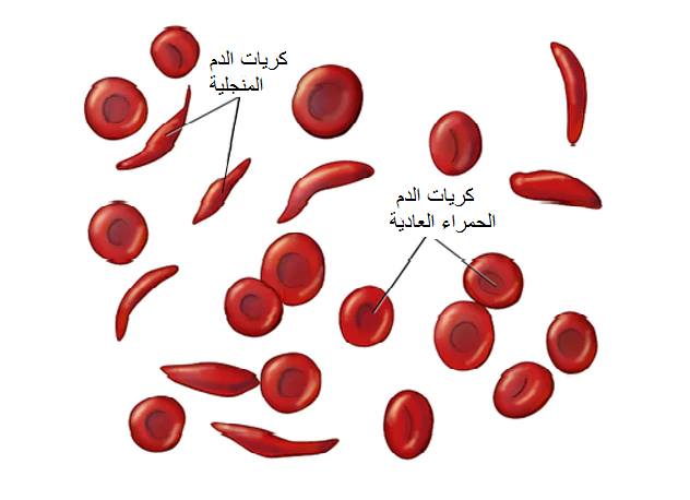 معنى Hgb في تحليل الدم